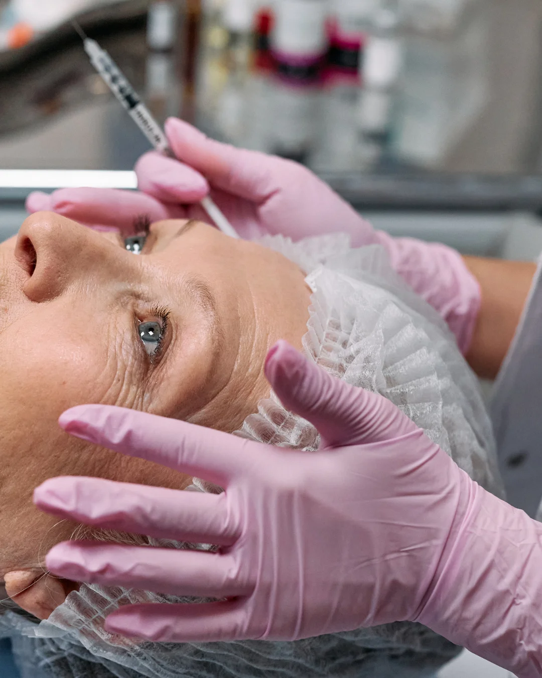 Botox at Healthy Minds Luxury Med Spa