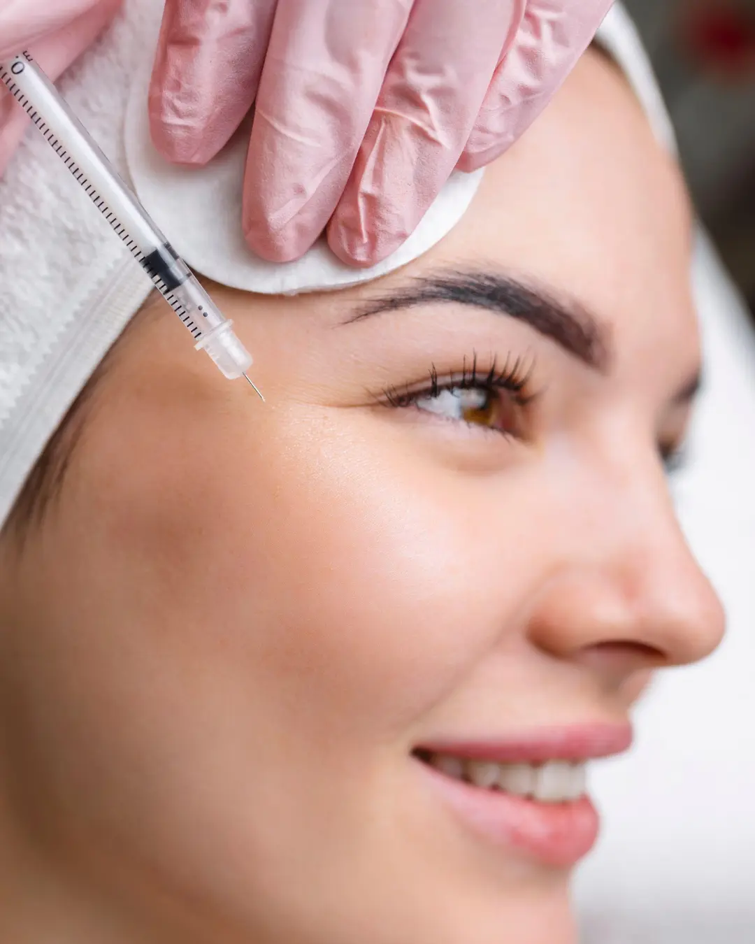 Crow's feet Botox treatment