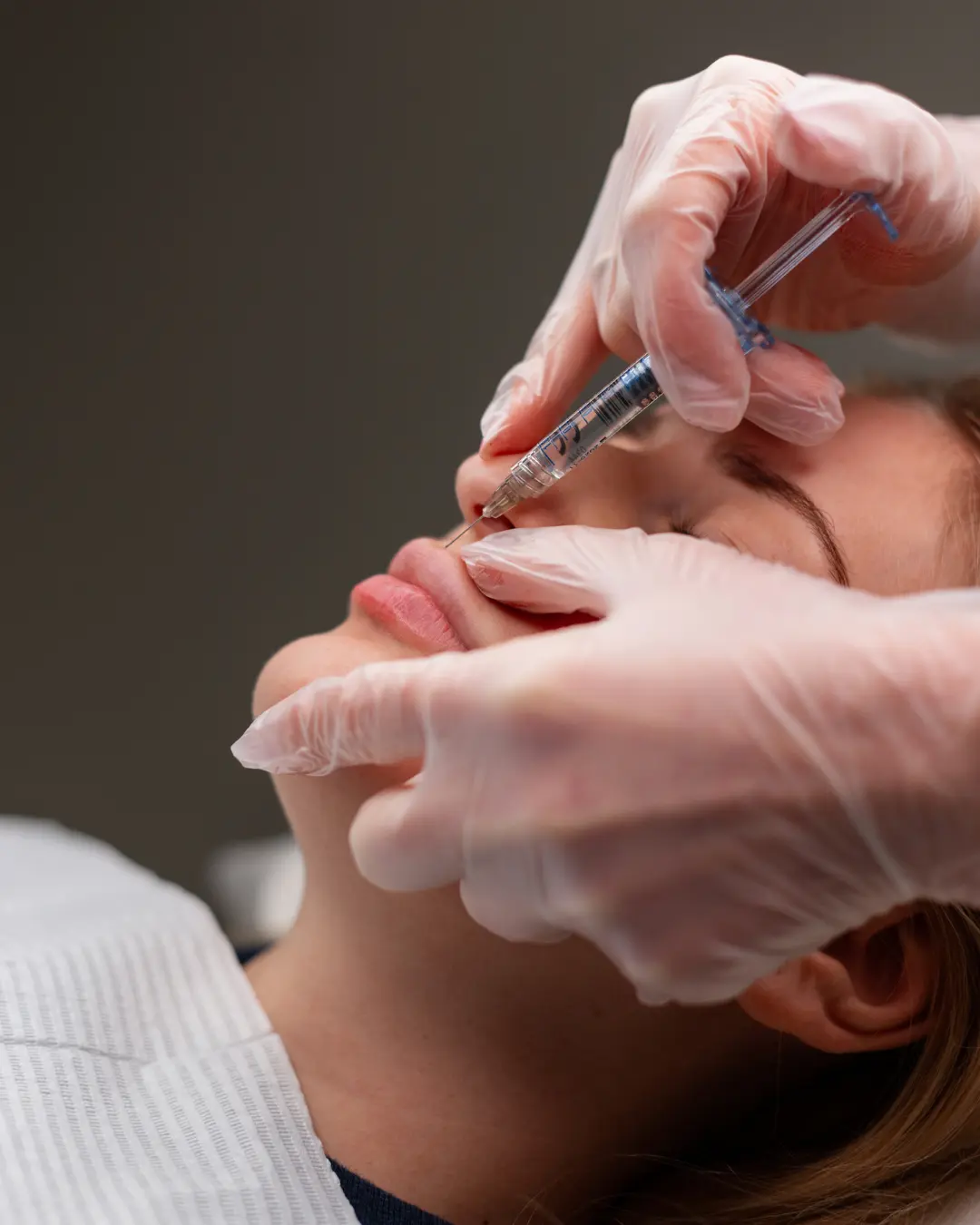 Lip flip Botox treatment