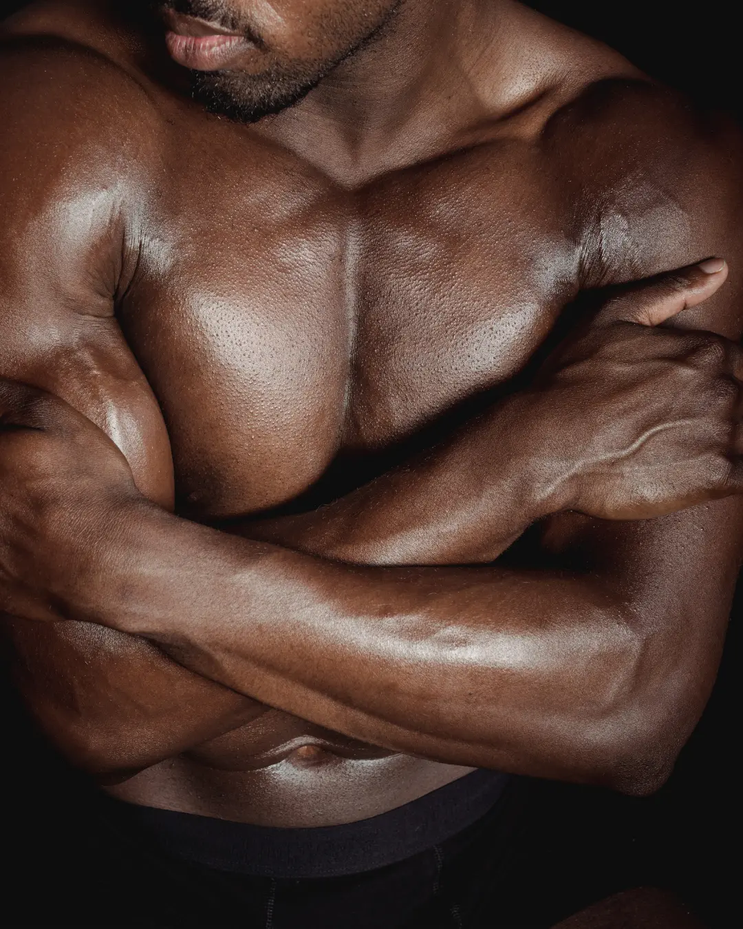 Hyperhidrosis Botox treatment