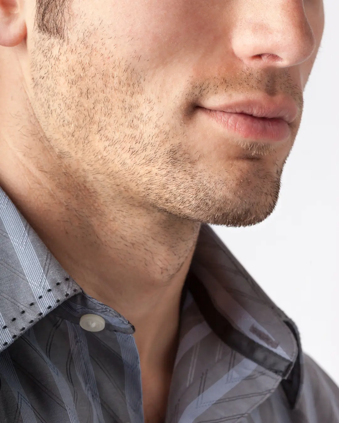 Chin augmentation filler treatment