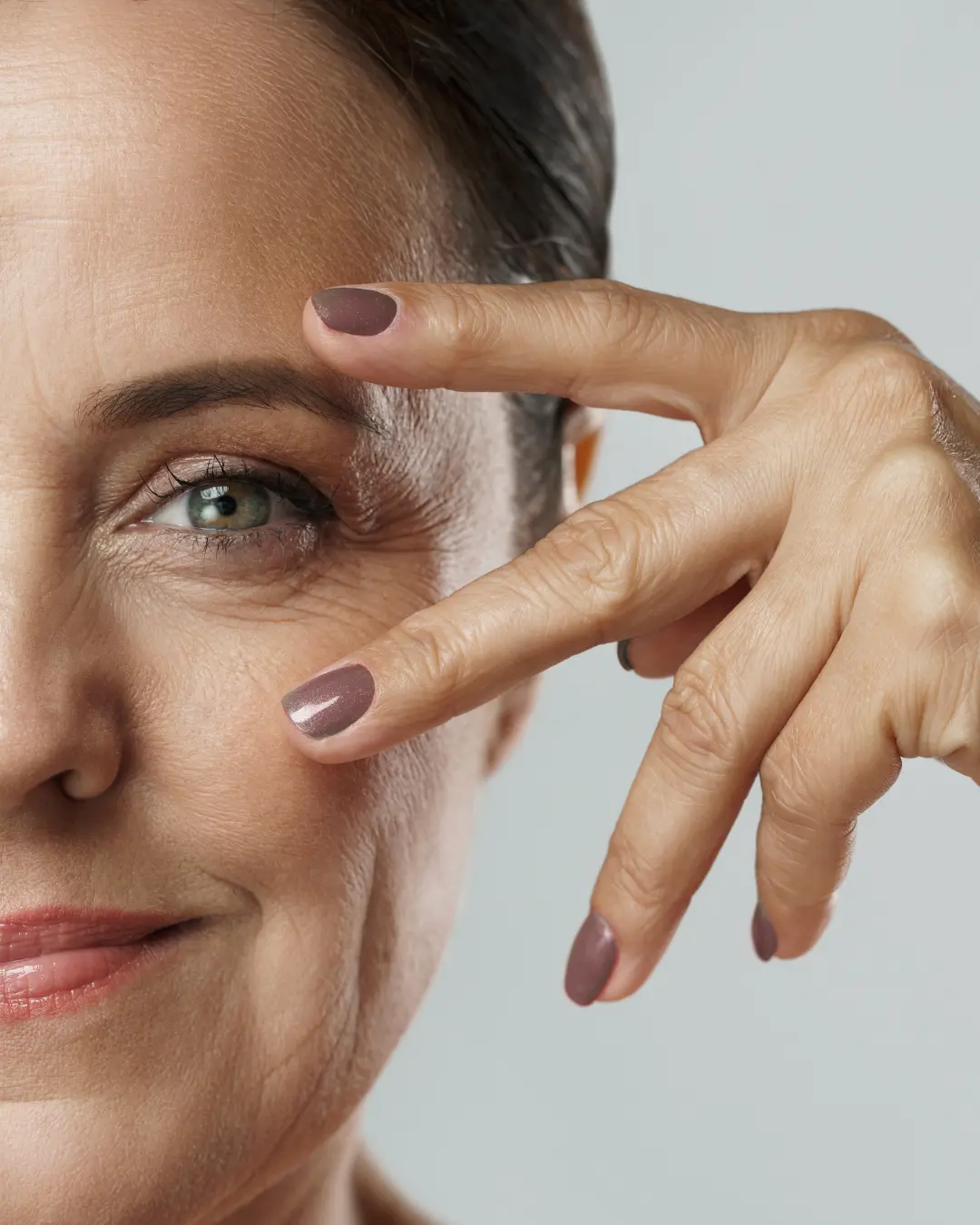 Fine lines and wrinkles microneedling treatment