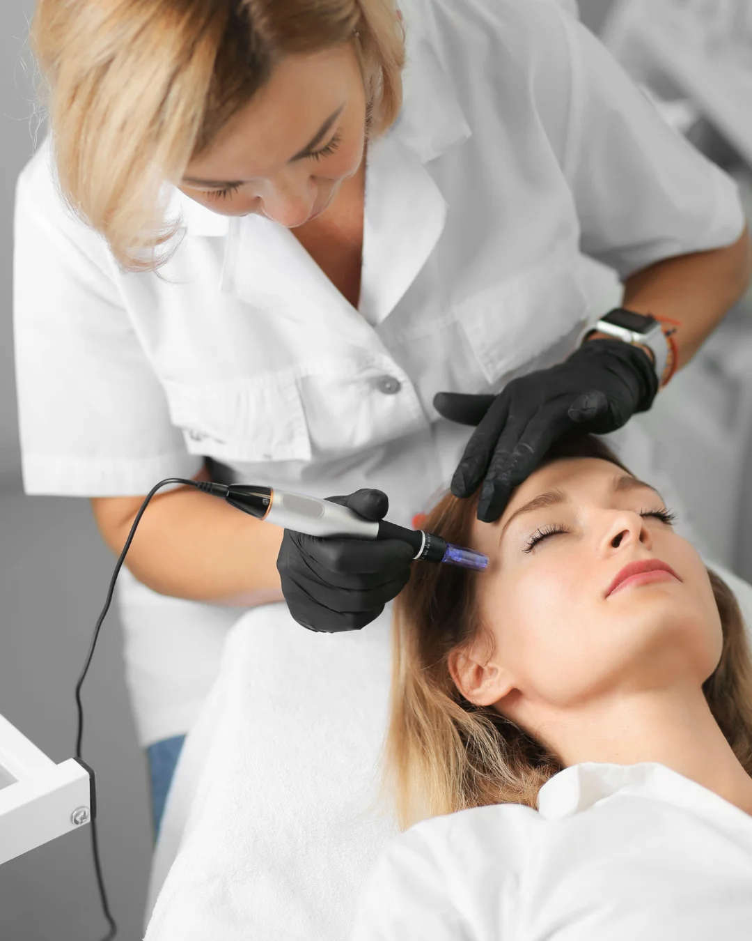 Microneedling treatment at Healthy Minds Luxury Med Spa
