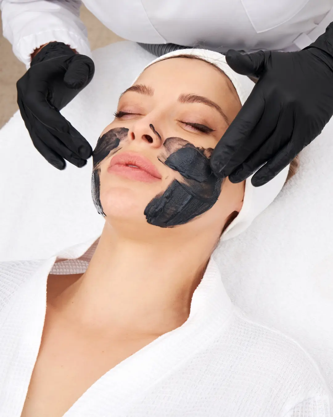 Medium peel targeted correction