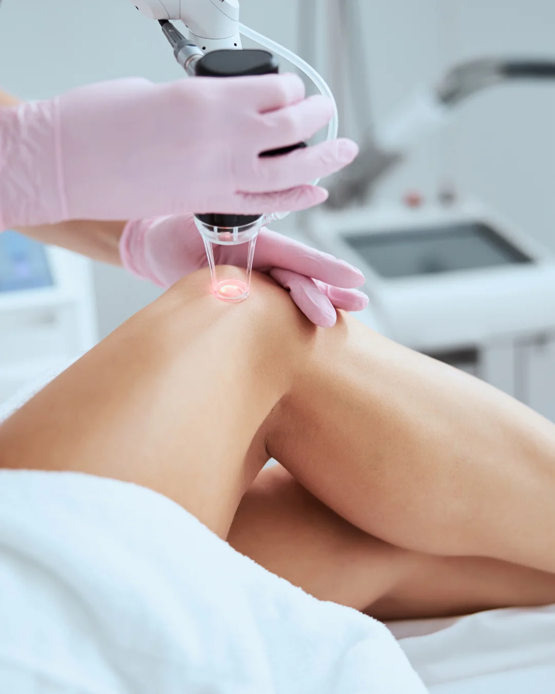 Spectrum Laser treatment at Healthy Minds Luxury Med Spa