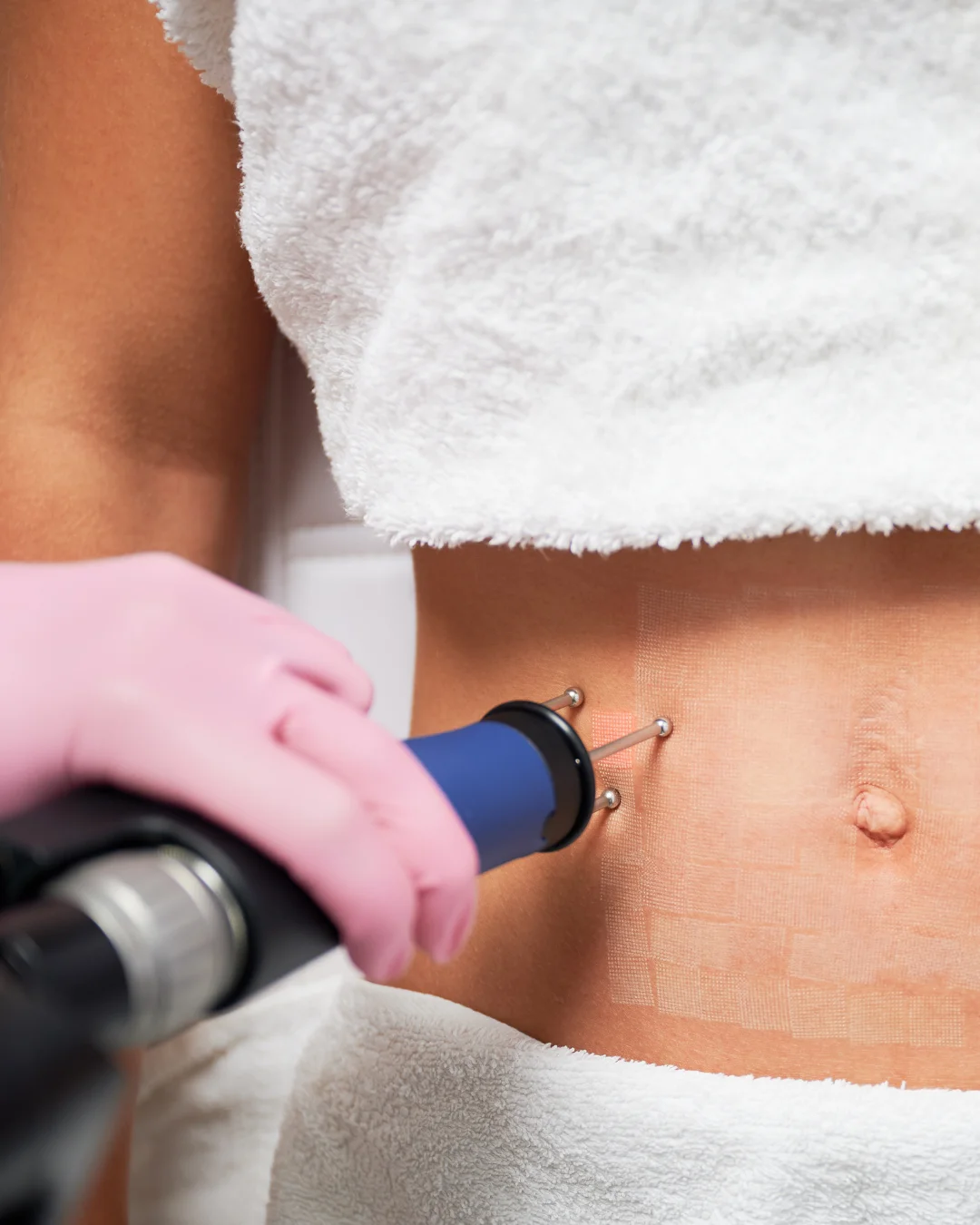 Professional laser care at Healthy Minds Luxury Med Spa